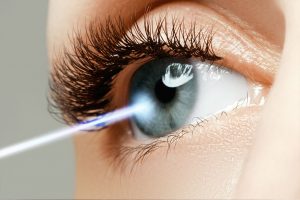 PRK laser vision correction