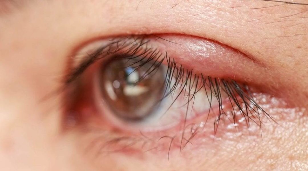 warm eye compress mask warm eye compress mask