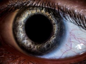 Cell loss cause Dementia