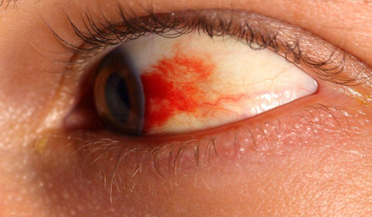 Diabetic Retinopathy Risk of Diabetic Retinopathy