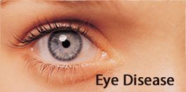 Eye Disease Management