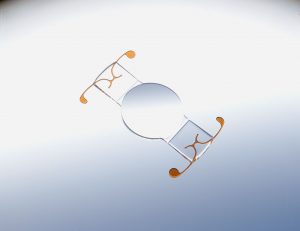 Advantages of TRULIGN lens