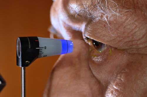 Woman putting eyedrops in 