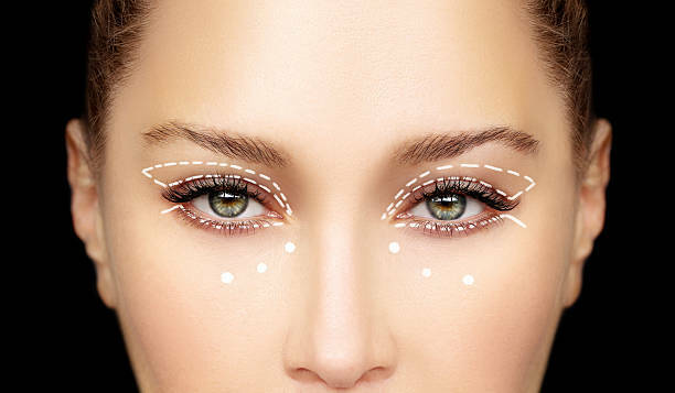 Eyelid Surgery at Brooks Eye Associates